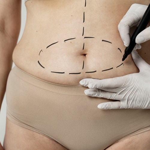 body sculpting milwaukee